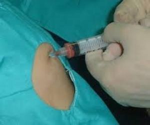 Foto:Tomada de Cubadebate Beneficiados pacientes en Camagüey con medicina regenerativa