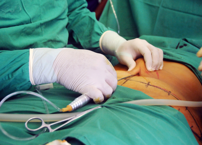 Fotos: Orlando Durán Hernández