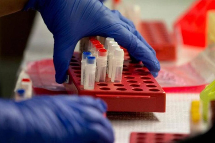 Crean en Cuba nuevo medicamento contra el cáncer cutáneo