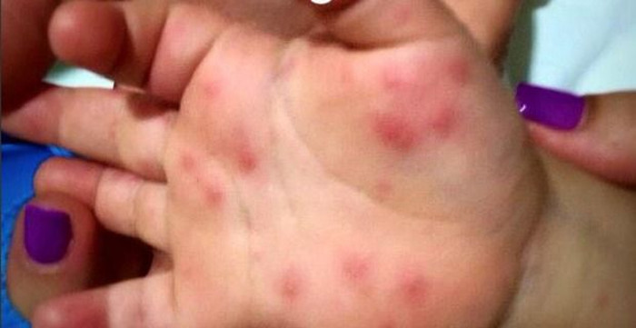 Photo: taken from www.cadenagramonte.cu/