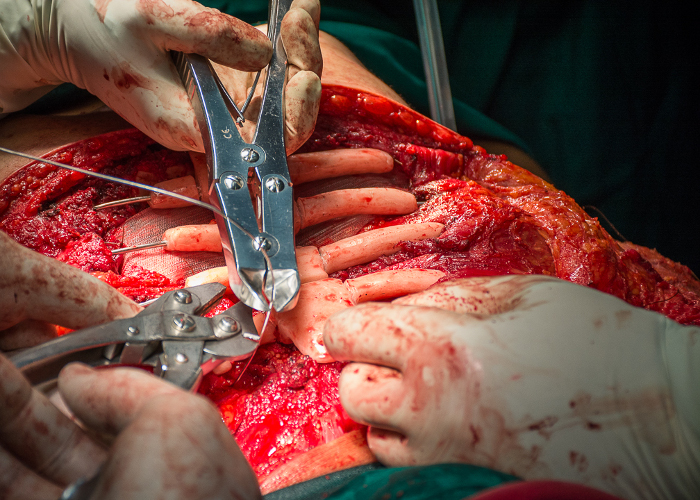 Photo: Leandro Pérez Pérez Adelante Surgical procedure for the first time in Cuba (+ Gallery)