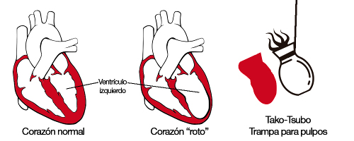 Imagen:Tomada de ecografiacardiaca