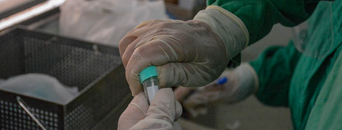 Nuevo caso de COVID-19 en Camagüey sin fuente de infección precisada