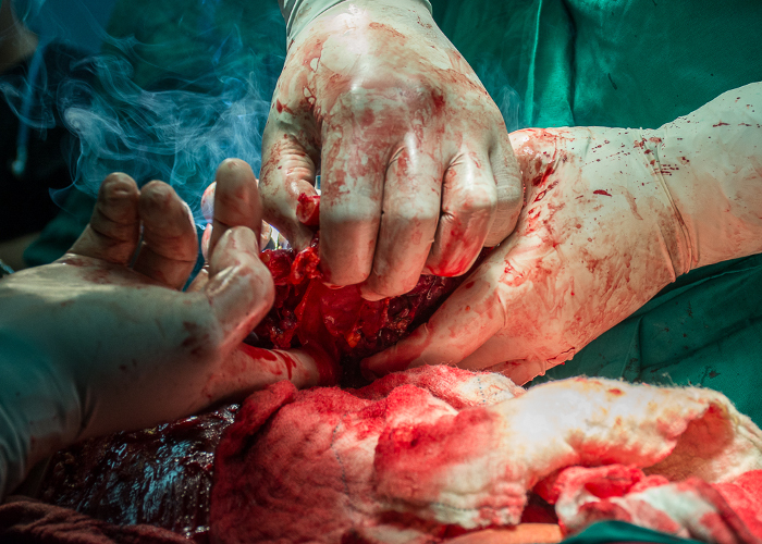 Foto: Leandro Pérez Pérez/Adelante