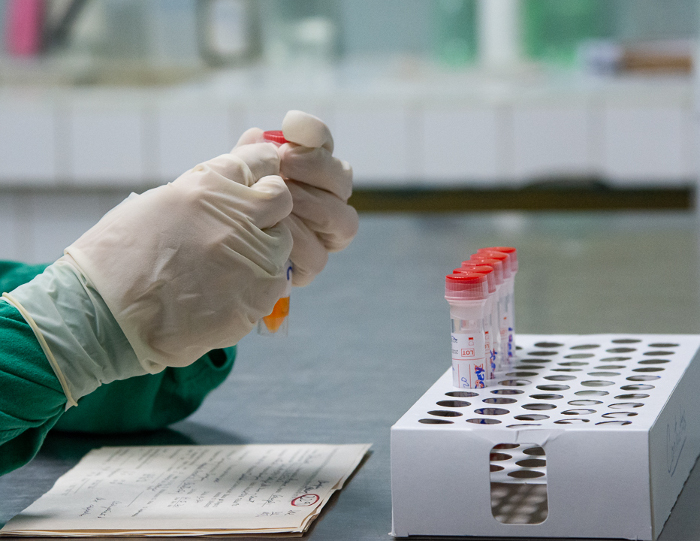 Foto: Leandro Pérez Pérez/ Adelante Colaboradora camagüeyana en Venezuela positiva al COVID-19