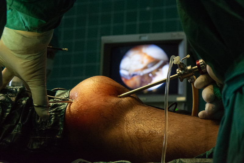 In Pediatric Hospital: first knee operations by arthroscopy