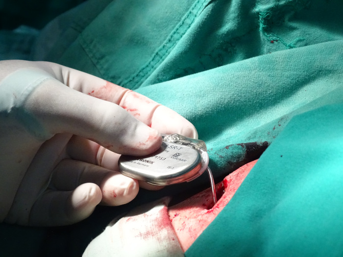 Corazones bloqueados: en espera de un impuls