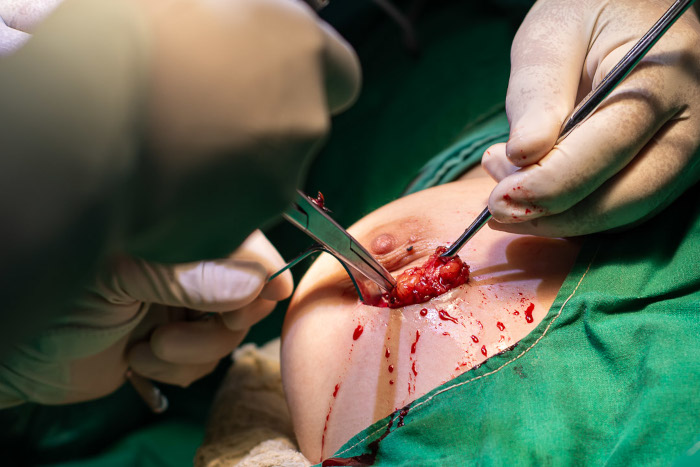 Photos: Leandro Pérez Pérez/Adelante