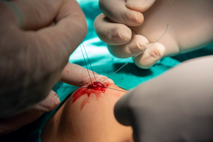 Encuentro de superación para ciruja