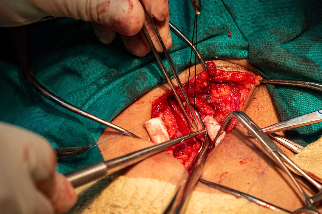 Fotos: Leandro Pérez Pérez/Adelante